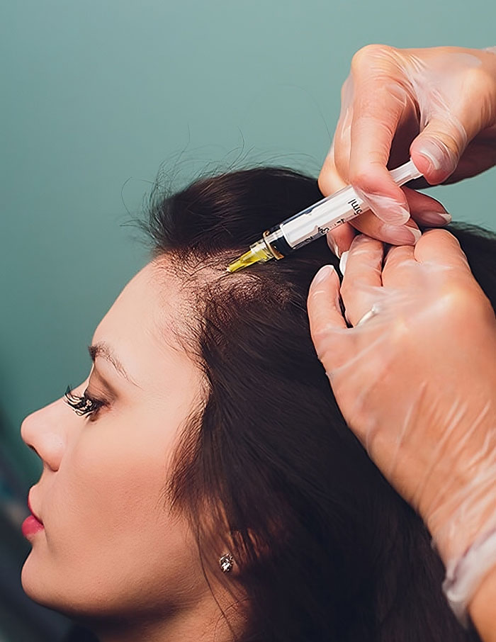 PRP & Mesotherapy